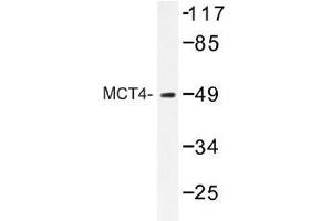 Image no. 1 for anti-Solute Carrier Family 16 (Monocarboxylic Acid Transporters), Member 3 (SLC16A3) antibody (ABIN317918)