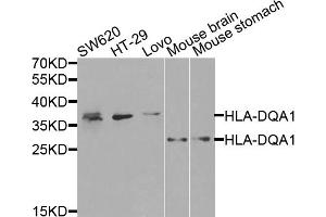 Western blot analysis of extracts of various cell lines, using HLA-DQA1 antibody (ABIN5971195) at 1/1000 dilution. (HLA-DQA1 抗体)