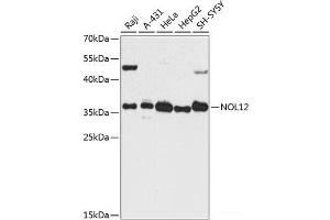 Western blot analysis of extracts of various cell lines using NOL12 Polyclonal Antibody at dilution of 1:3000. (NOL12 抗体)