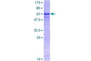 Image no. 1 for Receptor Tyrosine-Protein Kinase ErbB-3 (ERBB3) (AA 21-331) protein (GST tag) (ABIN1353017) (ERBB3 Protein (AA 21-331) (GST tag))