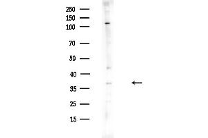 Western blot analysis of lysates from HUVEC cells(UV,30 min treatment), using MB Antibody at 1/1000 dilution.