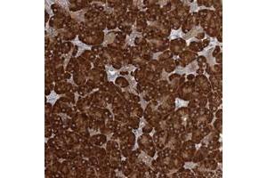 Immunohistochemical staining of human pancreas with FAM110C polyclonal antibody  shows strong cytoplasmic positivity in exocrine glandular cells at 1:200-1:500 dilution. (FAM110C 抗体)