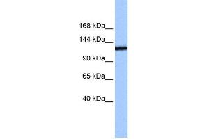 WB Suggested Anti-TEX2 Antibody Titration:  0. (TEX2 抗体  (N-Term))