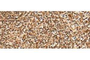 Immunohistochemistry of paraffin-embedded Human tonsil tissue using HOXC12 Polyclonal Antibody at dilution of 1:50(x200) (HOXC12 抗体)