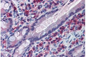 Rat Small Intestine: Formalin-Fixed, Paraffin-Embedded (FFPE) (CD163 抗体)