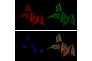 ABIN6264575 and ABIN6279739 staining HepG2 cells by IF/ICC. (RAB39A 抗体  (N-Term))