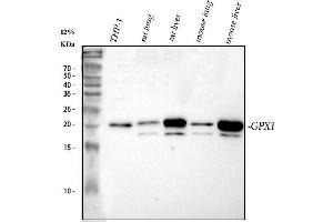 Western blot analysis of GPX1 using anti-GPX1 antibody (ABIN3043834). (Glutathione Peroxidase 1 抗体  (Middle Region))