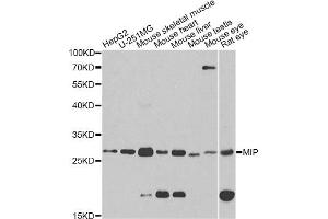 Western blot analysis of extracts of various cell lines, using MIP antibody (ABIN1873696) at 1:1000 dilution. (MIP 抗体)