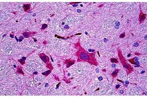 Immunohistochemistry (Formalin-fixed Paraffin-embedded Sections) (IHC (fp)) image for anti-Calcium/calmodulin-Dependent Protein Kinase II beta (CAMK2B) antibody (ABIN768905)