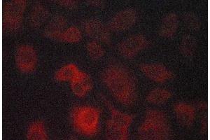 ABIN6268913 staining lovo cells by ICC/IF. (GRP78 抗体)