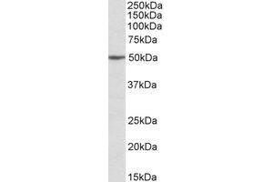 Western blot analysis: MON1A antibody staining of Jurkat lysate at 2 µg/ml (35µg protein in RIPA buffer). (MON1A 抗体  (Internal Region))