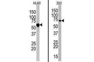 Image no. 1 for anti-Toll-Like Receptor 6 (TLR6) (N-Term) antibody (ABIN357054) (TLR6 抗体  (N-Term))