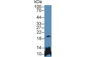 Western blot analysis of Mouse Cerebrum lysate, using Human GH Antibody (5 µg/ml) and HRP-conjugated Goat Anti-Rabbit antibody ( (Growth Hormone 1 抗体  (AA 28-217))