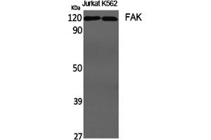 Western Blotting (WB) image for anti-PTK2 Protein tyrosine Kinase 2 (PTK2) (Tyr407) antibody (ABIN5960987) (FAK 抗体  (Tyr407))