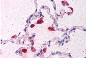 Human Lung (formalin-fixed, paraffin-embedded) stained with IFNB1 antibody ABIN213936 at 5 ug/ml followed by biotinylated goat anti-rabbit IgG secondary antibody ABIN481713, alkaline phosphatase-streptavidin and chromogen. (IFNB1 抗体  (Internal Region))