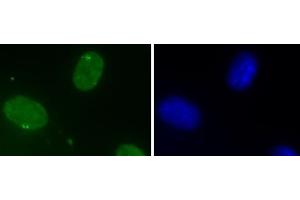 DHX9 antibody (mAb) (Clone 8E3) tested by Immunofluorescence. (DHX9 抗体  (N-Term))