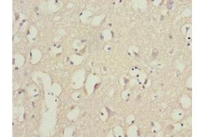 Immunohistochemistry of paraffin-embedded human brain tissue using ABIN7163171 at dilution of 1:100 (PIK3R3 抗体  (Regulatory Subunit Gamma))