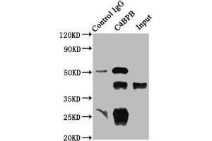 Immunoprecipitating C4BPB in HepG2 whole cell lysate Lane 1: Rabbit control IgG instead of ABIN7146168 in HepG2 whole cell lysate. (C4BPB 抗体  (AA 18-252))