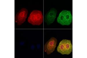 ABIN7094172 and ABIN7098217 staining Hela cells by IF/ICC.