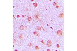 Immunohistochemical analysis of PFKP staining in human brain formalin fixed paraffin embedded tissue section. (PFKP 抗体  (Center))