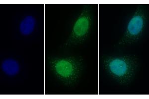 Detection of LSR in Human HepG2 cell using Polyclonal Antibody to Lipolysis Stimulated Lipoprotein Receptor (LSR) (LSR 抗体  (AA 35-205))