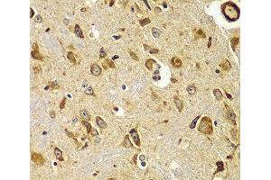 Immunohistochemistry of paraffin-embedded Mouse brain using SMAD9 Polyclonal Antibody at dilution of 1:100 (40x lens). (SMAD9 抗体)