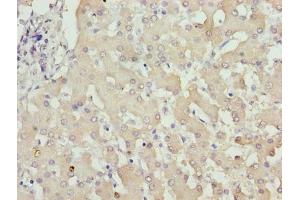 Immunohistochemistry of paraffin-embedded human liver tissue using ABIN7176493 at dilution of 1:100 (ZNF643 抗体  (AA 15-310))