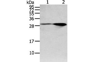 Gel: 12 % SDS-PAGE, Lysate: 40 μg, Lane 1-2: Mouse brain and human fetal brain tissue, Primary antibody: ABIN7128020(SPIN4 Antibody) at dilution 1/200 dilution, Secondary antibody: Goat anti rabbit IgG at 1/8000 dilution, Exposure time: 1 minute (SPIN4 抗体)