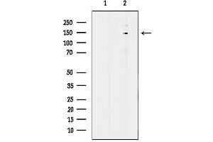 anti-DEAH (Asp-Glu-Ala-His) Box Polypeptide 38 (DHX38) (C-Term) antibody