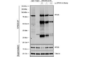Immunoprecipitation analysis using Mouse Anti-VPS35 Monoclonal Antibody, Clone 7E4 (ABIN6932912). (VPS35 抗体  (Atto 594))
