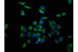 Immunofluorescence staining of Hela cells with ABIN7161665 at 1:200, counter-stained with DAPI. (OPRL1 抗体  (AA 323-370))