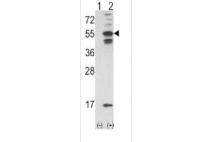Western blot analysis of CAMK2A using rabbit polyclonal C using 293 cell lysates (2 ug/lane) either nontransfected (Lane 1) or transiently transfected with the CAMK2A gene (Lane 2). (CAMK2A 抗体  (C-Term))