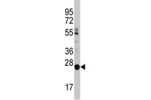 Western blot analysis of LIN28B antibody and HL-60 lysate (LIN28B 抗体  (AA 218-250))