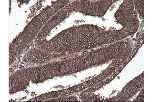 Image no. 2 for anti-Cancer/testis Antigen 1B (CTAG1B) antibody (ABIN1499906) (CTAG1B 抗体)