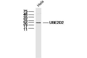 Hela lysates probed with UBE2D2 Polyclonal Antibody, Unconjugated  at 1:300 dilution and 4˚C overnight incubation. (UBE2D2 抗体  (AA 31-130))