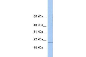 Human Placenta; WB Suggested Anti-ZNHIT3 Antibody Titration: 0.