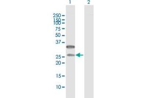 Western Blot analysis of CD79B expression in transfected 293T cell line by CD79B MaxPab polyclonal antibody. (CD79b 抗体  (AA 1-229))