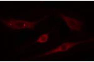 Immunofluorescence (fixed cells) (IF/ICC) image for anti-ADAM Metallopeptidase with thrombospondin Type 1 Motif, 18 (ADAMTS18) (C-Term) antibody (ABIN6259060)