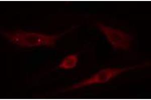 ABIN6274811 staining NIH-3T3 cells by IF/ICC. (ADAMTS18 抗体  (C-Term))