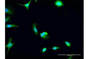 Immunofluorescence of purified MaxPab antibody to C8orf33 on HeLa cell. (C8orf33 抗体  (AA 1-229))