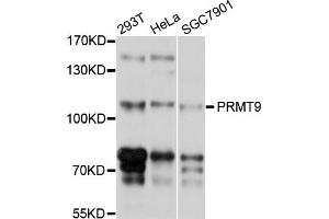 Western blot analysis of extracts of various cell lines, using PRMT9 antibody (ABIN4904870) at 1:1000 dilution. (FBXO11 抗体)