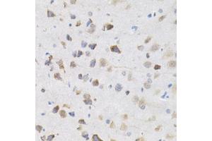 Immunohistochemistry of paraffin-embedded rat brain using KPNA4 Antibody (ABIN5971058) at dilution of 1/200 (40x lens). (KPNA4 抗体)