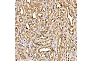 Immunohistochemistry (IHC) image for anti-ATP Citrate Lyase (ACLY) (AA 752-1101) antibody (ABIN7265716)
