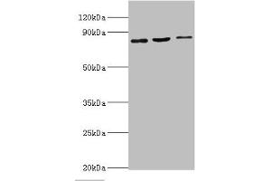 Western blot All lanes: SATB1 antibody at 2 μg/mL Lane 1: Mouse brain tissue Lane 2: 293T whole cell lysate Lane 3: Jurkat whole cell lysate Secondary Goat polyclonal to rabbit IgG at 1/10000 dilution Predicted band size: 86, 90 kDa Observed band size: 86 kDa (SATB1 抗体  (AA 484-763))