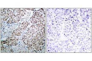 Immunohistochemistry (IHC) image for anti-Tumor Protein P53 (TP53) (pSer315) antibody (ABIN7138550)