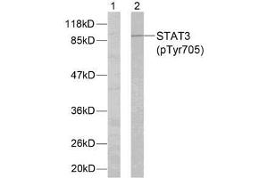 Western blot analysis of extracts from HeLa cells using STAT3 (phospho-Tyr705) antibody (E011045). (STAT3 抗体  (pTyr705))