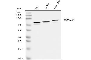 Western blot analysis of HSD17B4 using anti-HSD17B4 antibody (ABIN5518845).