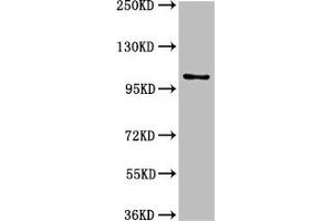 Western Blot Positive WB detected in: U87 whole cell lysate All lanes: AMPD2 antibody at 3 μg/mL Secondary Goat polyclonal to rabbit IgG at 1/50000 dilution Predicted band size: 101, 93, 89 kDa Observed band size: 101 kDa (AMPD2 抗体  (AA 1-129))