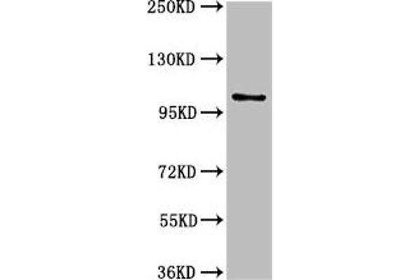 AMPD2 抗体  (AA 1-129)