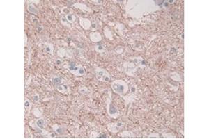 Immunohistochemistry (Paraffin-embedded Sections) (IHC (p)) image for anti-Plasminogen Activator Inhibitor 1 (SERPINE1) (AA 25-402) antibody (ABIN5662373)